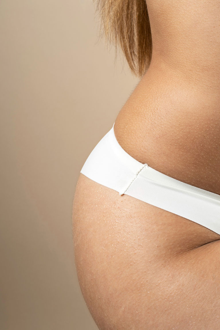 Anti-estrías hidratante. Aceite fermentado. Pieles normales y mixtas. 100 ml. Anti-estrías hidratante. Aceite fermentado. Pieles normales y mixtas. 100 ml. - Imagen 2